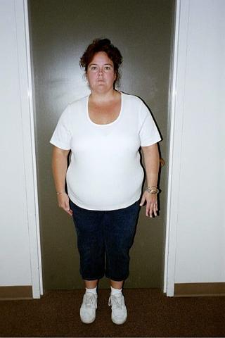 Oct 14 Pre-op appt