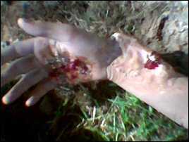 Realistic 1st Aid make-up by Aqua
