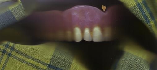 /user/dentures2.JPG