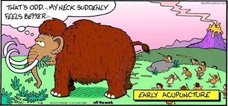 acupuncture
