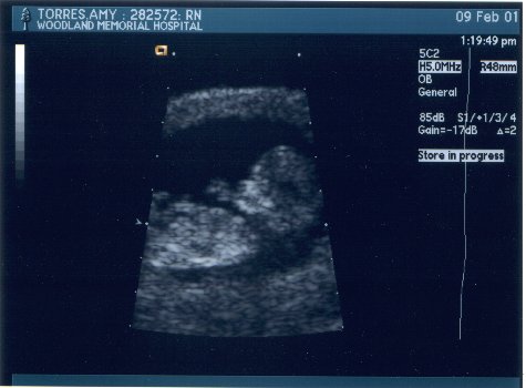 [Baby 3]