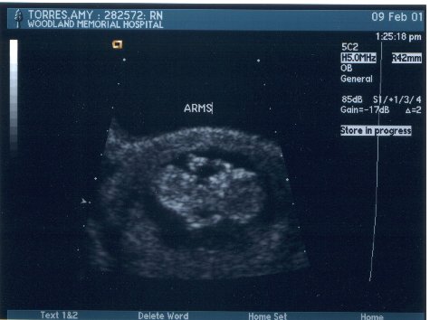 [Baby 4]