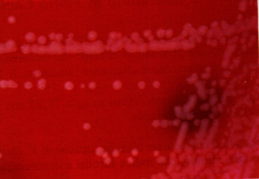 Cjejuni.jpg (32621 bytes)