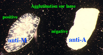br14_agglutinazione.jpg (46931 bytes)