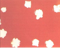 nocardia.jpg (10734 bytes)
