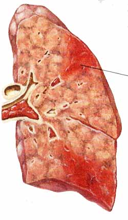 homocystin4.jpg (24556 bytes)