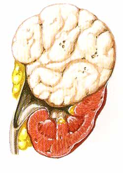 wilmtumour.jpg (20666 bytes)