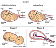 Click to view Labor Stages