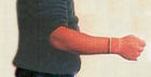 Hand nachher