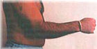 Hand vorher
