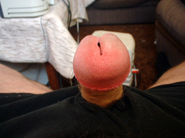 Knob