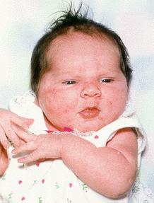 newborn