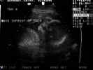 Twin-A-wks-frnt-head-2-11-98.JPG (9067 bytes)