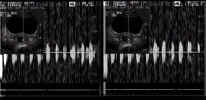 heartbeat.jpg (26600 bytes)