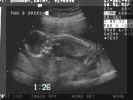 twinb-spine.jpg (12587 bytes)