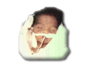 Andy at Birth