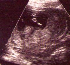 baby waves at ya all
