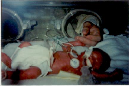 Hendrix in incubator 7-01