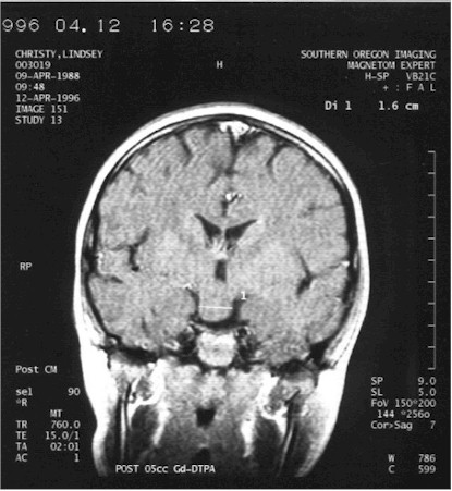 mrilindseyback.jpg (54584 bytes)