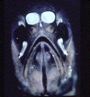 headlite
