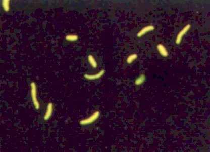 BACILO FLUORESCENTE