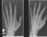 hand x-ray
