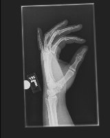 hand x-ray