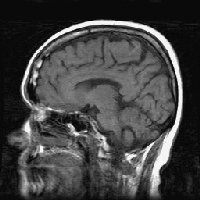 MRI image