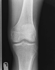 kneeap.JPG (6916 bytes)