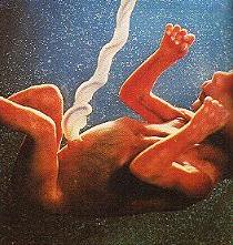 cordon umbilical