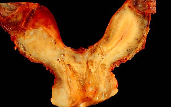 specimen
image