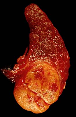 specimen
image