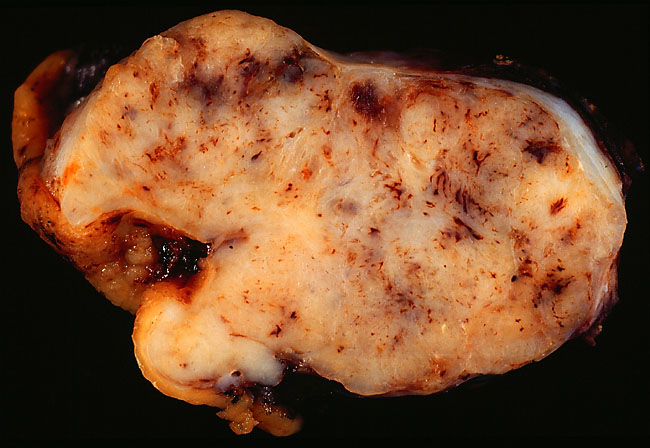 specimen
image