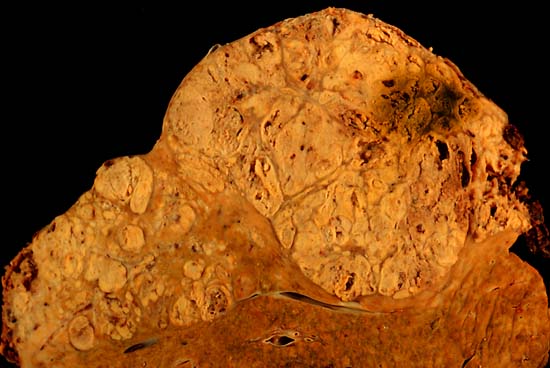 specimen
image