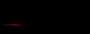 ekg.gif (6824 bytes)