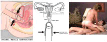 Vaginal walls contracting