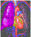 Cardiovascular System