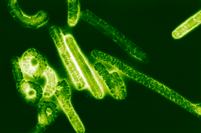 EBOLA FLUORESCENTE