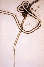 MICROFOTOGRAFIA DEL VIRUS EBOLA