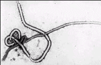 MICROFOTOGRAFIA DEL VIRUS EBOLA