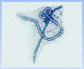 MICROFOTOGRAFIA DEL VIRUS EBOLA