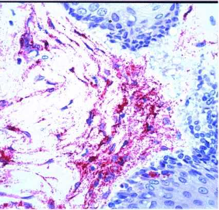 EBOLA HISTOPATOLOGIA