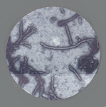 VIRUS EBOLA AL MICROSCOPIO