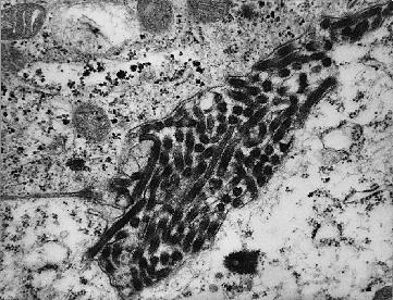 VIRUS MARBURG AL MICROSCOPIO ELECTRONICO