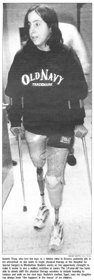 Ibadete on Crutches with Prosthetic legs