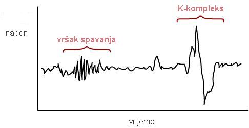 Slika sa mozdanim valovima.
