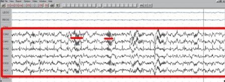Slika sa mozdanim valovima.