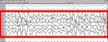 Slika sa mozdanim valovima.