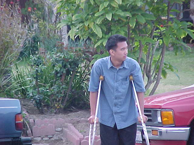 broken leg