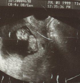 Breanna, July 1, 1999